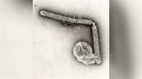 Response to bird flu outbreak is ‘robust,’ CDC says, although risk .
